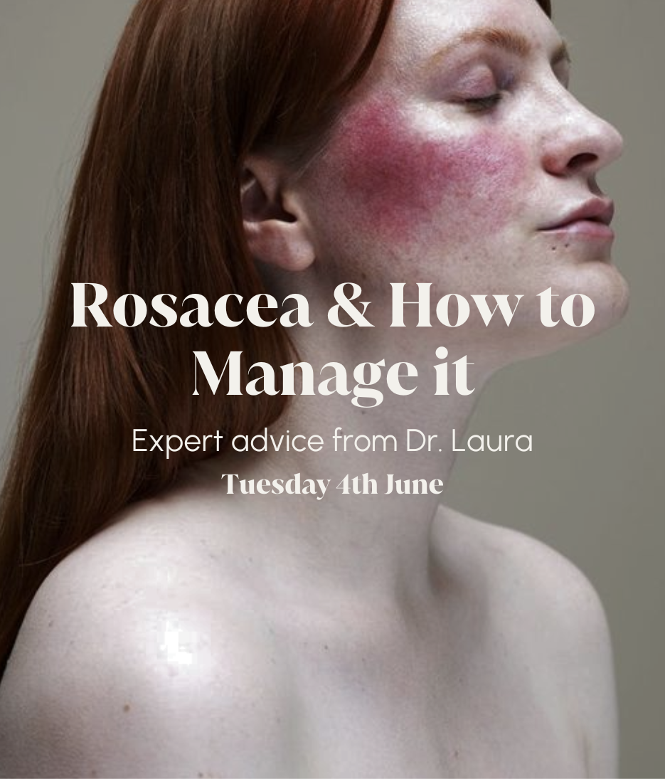 Skincare Chats: Rosacea & How to Manage it