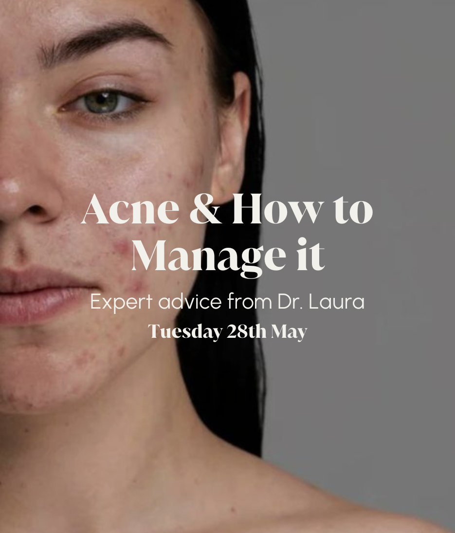Skincare Chats: Acne & How to Manage it