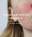 Dr. Laura clinic skin chats rosacea and how to manage it